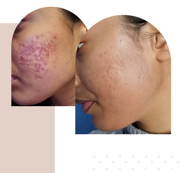 Before and After Medical-Grade Skincare 