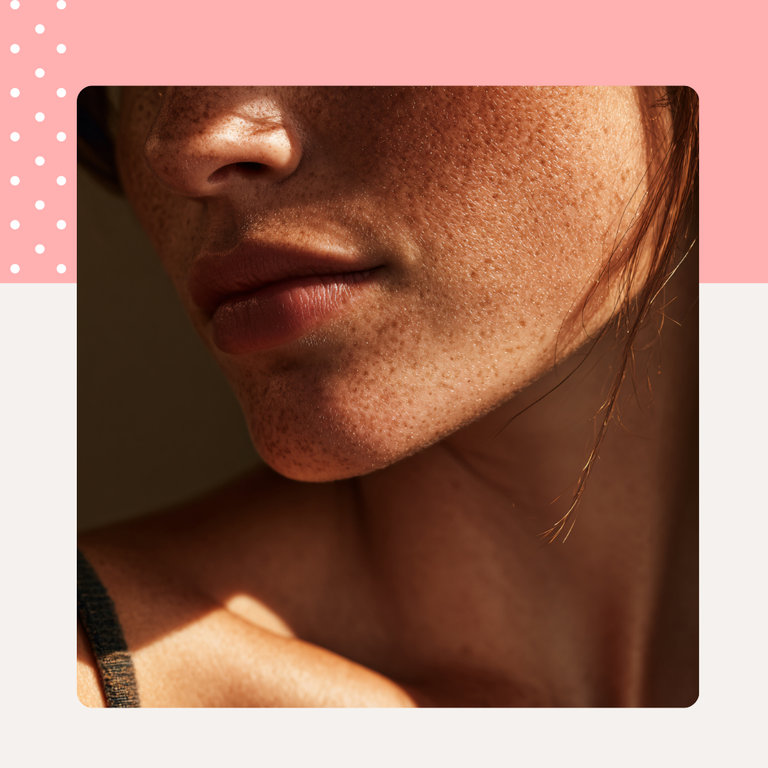 skincare tips for people with very dry skin, skin conditions