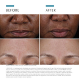 Before-and-after comparison collage showing close-up views of a person's lower face and forehead to demonstrate skin texture and wrinkle improvement, with explanatory text at the bottom.