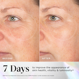 Before and after comparison of a woman's face with text about skin health improvement.