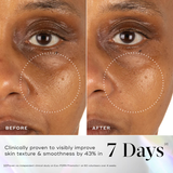 Before and after comparison of skin texture improvement on a person's face, with text indicating clinical proven results.