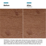 Before and after comparison of skin texture with text indicating a clinical study protocol.