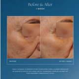 Before and after skin hydration comparison on a blue background IS Clinical Daily Dynamic Hydrator