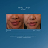 Before and after skin hydration comparison on a blue background IS Clinical Daily Dynamic Hydrator