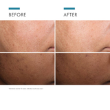 Before and after Discoloration Defense Serum