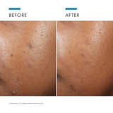 Phyto A+ Brightening Treatment